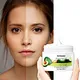Whitening